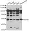 NOP2/Sun RNA Methyltransferase 6 antibody, LS-C748502, Lifespan Biosciences, Western Blot image 