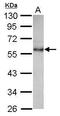 Carbohydrate Sulfotransferase 9 antibody, PA5-30842, Invitrogen Antibodies, Western Blot image 