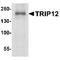 Probable E3 ubiquitin-protein ligase TRIP12 antibody, TA349096, Origene, Western Blot image 