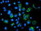 Adenylate kinase isoenzyme 4, mitochondrial antibody, TA503199, Origene, Immunofluorescence image 