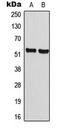 Cyclin-A1 antibody, MBS827583, MyBioSource, Western Blot image 