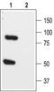 TWIK1 antibody, TA328620, Origene, Western Blot image 