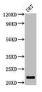 Adenylate kinase isoenzyme 1 antibody, CSB-PA001508HA01HU, Cusabio, Western Blot image 