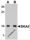 Spindle And Kinetochore Associated Complex Subunit 2 antibody, 5403, ProSci, Western Blot image 