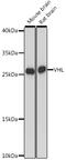 Von Hippel-Lindau Tumor Suppressor antibody, 16-528, ProSci, Western Blot image 