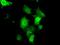 Cilia And Flagella Associated Protein 298 antibody, MA5-25158, Invitrogen Antibodies, Immunocytochemistry image 