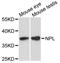 N-acetylneuraminate lyase antibody, A9210, ABclonal Technology, Western Blot image 