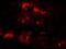 Equilibrative nucleoside transporter 3 antibody, A04749, Boster Biological Technology, Immunofluorescence image 
