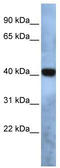 Transmembrane Protein 115 antibody, TA341876, Origene, Western Blot image 