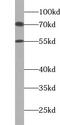 Zinc Finger Protein 266 antibody, FNab09677, FineTest, Western Blot image 