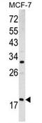 ADP-ribosylation factor 3 antibody, AP17123PU-N, Origene, Western Blot image 