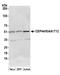 Centrosomal Protein 44 antibody, A304-955A, Bethyl Labs, Western Blot image 