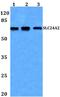 Solute Carrier Family 24 Member 2 antibody, A11621, Boster Biological Technology, Western Blot image 