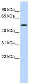 Tripartite Motif Containing 55 antibody, TA330490, Origene, Western Blot image 