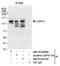 Ubiquitin carboxyl-terminal hydrolase 37 antibody, NB110-40696, Novus Biologicals, Western Blot image 