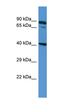 Zinc Finger DHHC-Type Containing 11B antibody, orb325521, Biorbyt, Western Blot image 