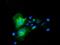 Caseinolytic Mitochondrial Matrix Peptidase Proteolytic Subunit antibody, MA5-25330, Invitrogen Antibodies, Immunocytochemistry image 