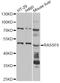 Ras Association Domain Family Member 6 antibody, LS-C749175, Lifespan Biosciences, Western Blot image 