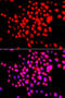 Serine/Threonine Kinase 19 antibody, 14-962, ProSci, Immunofluorescence image 
