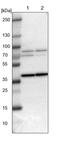 Polypeptide N-Acetylgalactosaminyltransferase 17 antibody, PA5-53072, Invitrogen Antibodies, Western Blot image 