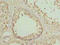 Down syndrome critical region protein 9 antibody, A62438-100, Epigentek, Immunohistochemistry paraffin image 