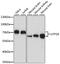 UTP18 Small Subunit Processome Component antibody, 16-048, ProSci, Western Blot image 