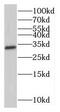 N-Methylpurine DNA Glycosylase antibody, FNab05281, FineTest, Western Blot image 