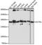 Dynactin Subunit 1 antibody, A1783, ABclonal Technology, Western Blot image 