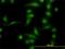 Aldo-Keto Reductase Family 1 Member B10 antibody, H00057016-M01, Novus Biologicals, Immunofluorescence image 