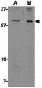 Chromosome 12 Open Reading Frame 75 antibody, GTX85351, GeneTex, Western Blot image 