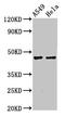 Neuromedin B Receptor antibody, LS-C670791, Lifespan Biosciences, Western Blot image 