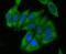 Acyl-CoA Dehydrogenase Medium Chain antibody, NBP2-80447, Novus Biologicals, Immunofluorescence image 