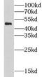 Cholinergic Receptor Nicotinic Alpha 10 Subunit antibody, FNab01675, FineTest, Western Blot image 