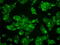 Mitogen-Activated Protein Kinase Kinase 4 antibody, GTX84162, GeneTex, Immunofluorescence image 