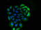 CD14 antibody, LS-C763563, Lifespan Biosciences, Immunofluorescence image 