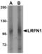 Leucine Rich Repeat And Fibronectin Type III Domain Containing 1 antibody, MBS150597, MyBioSource, Western Blot image 