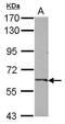 Complement C9 antibody, PA5-29093, Invitrogen Antibodies, Western Blot image 