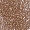 Zinc Finger Protein 584 antibody, NBP2-47564, Novus Biologicals, Immunohistochemistry paraffin image 