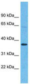 Olfactory Receptor Family 5 Subfamily H Member 15 antibody, TA337528, Origene, Western Blot image 