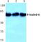 Frizzled Class Receptor 6 antibody, PA5-75511, Invitrogen Antibodies, Western Blot image 