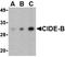Cell Death Inducing DFFA Like Effector B antibody, orb74423, Biorbyt, Western Blot image 