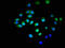 Ubiquitin Conjugating Enzyme E2 E3 antibody, LS-C672091, Lifespan Biosciences, Immunofluorescence image 