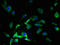 Solute Carrier Family 38 Member 7 antibody, LS-C380144, Lifespan Biosciences, Immunofluorescence image 