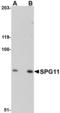 SPG11 Vesicle Trafficking Associated, Spatacsin antibody, A03005, Boster Biological Technology, Western Blot image 