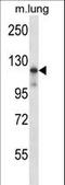 Mitogen-Activated Protein Kinase Kinase Kinase 14 antibody, LS-C164452, Lifespan Biosciences, Western Blot image 