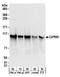 Cell Cycle Associated Protein 1 antibody, A303-882A, Bethyl Labs, Western Blot image 