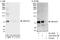 Protein CBFA2T2 antibody, A303-593A, Bethyl Labs, Western Blot image 