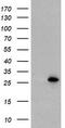 Ubiquitin Conjugating Enzyme E2 E3 antibody, TA800059AM, Origene, Western Blot image 
