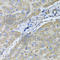 UDP Glucuronosyltransferase Family 2 Member B10 antibody, A7570, ABclonal Technology, Immunohistochemistry paraffin image 