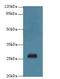 Chromosome 17 Open Reading Frame 64 antibody, A65850-100, Epigentek, Western Blot image 